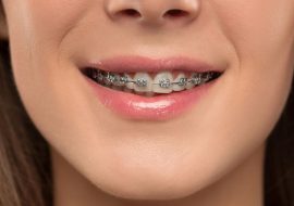 Na czym polega praca ortodonty?