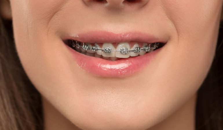 Na czym polega praca ortodonty?
